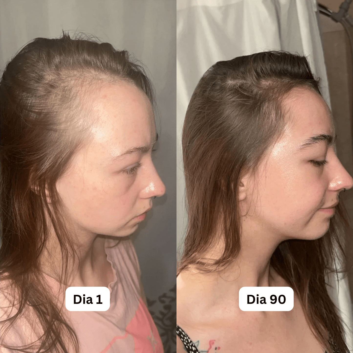 Sormira™ Roll-On Anti-Queda