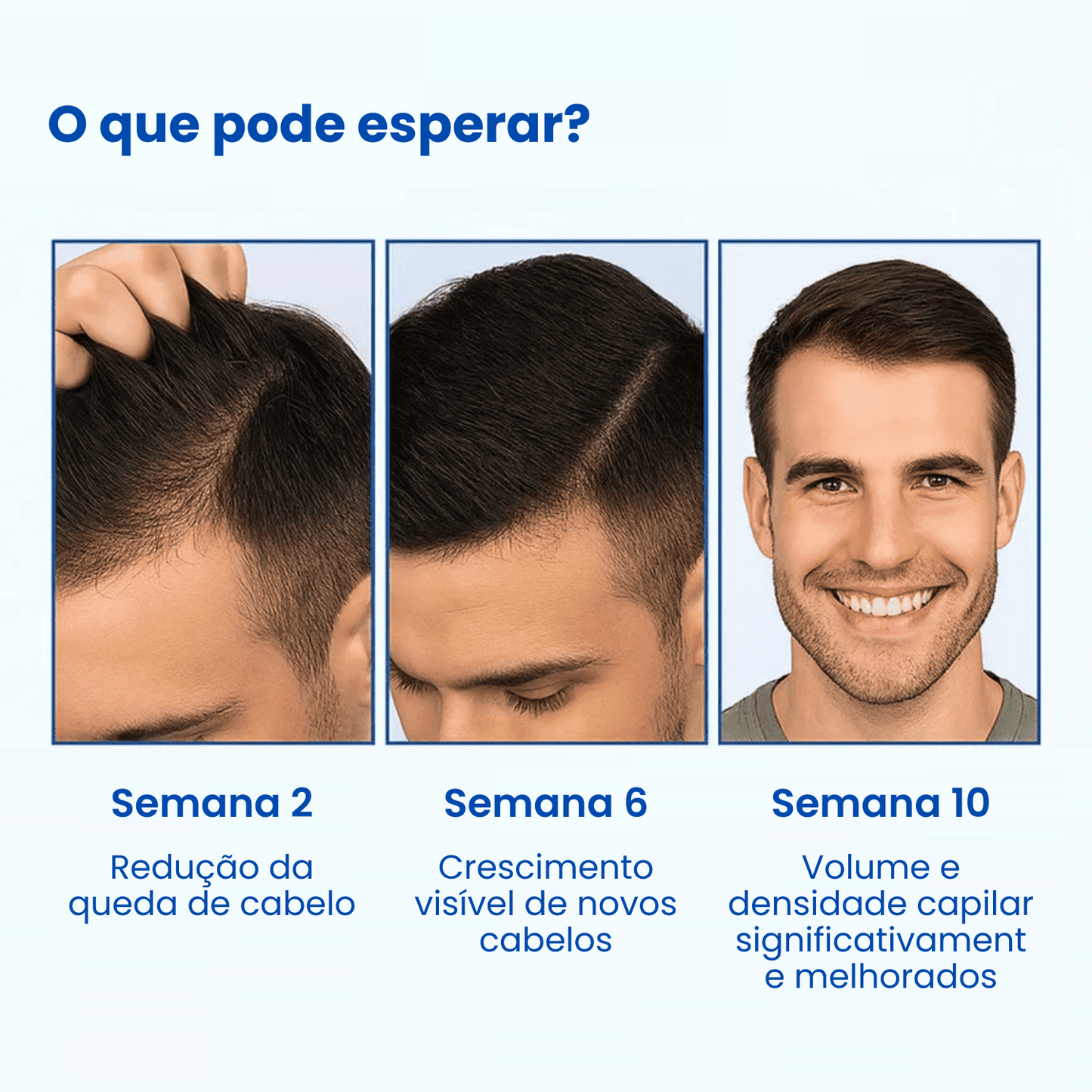 Sormira Roll-on para crescimento capilar