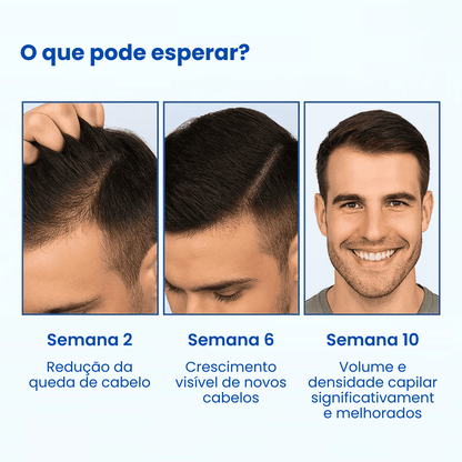 Sormira Roll-on para crescimento capilar